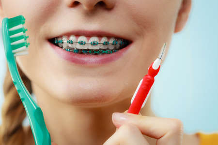 Dentist and orthodontist concept. Young woman with blue braces cleaning and brushing teeth using two...