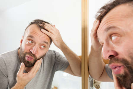 Worried adult man looking in bathroom mirror at his decreasing hairline thinking about hair care...