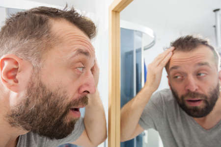 Worried adult man looking in bathroom mirror at his decreasing hairline thinking about hair care treatmentの写真素材