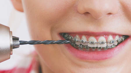 Funny teenage woman wearing teeth braces holding drill about to take brace off.の写真素材