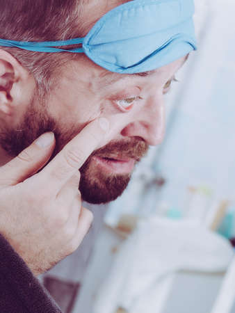 Funny adult man wearing eyemask on forhead having troubles with waking up. Standing in front of mirror investigating imperfections on his face.の写真素材