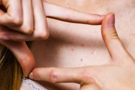 Health problem, skin diseases. Young woman showing her neckline with acne, red spots. Female with...
