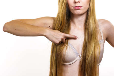 Health problem, skin diseases. Young woman showing her neckline with acne, red spots. Female with...