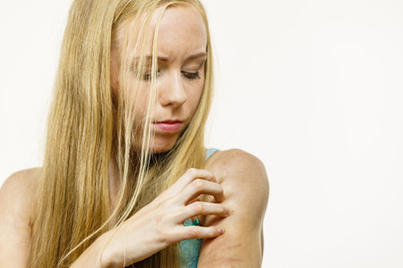 Itchy skin, dermatitis, food allergies. Woman having itching, scratching her arm with allergy rash.の写真素材
