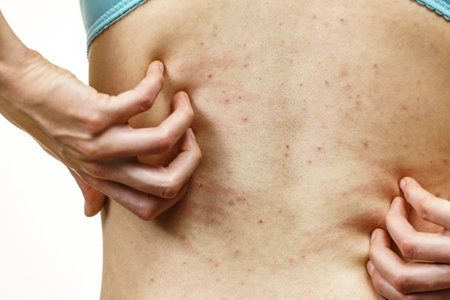 Itchy skin, dermatitis, food allergies. Woman showing her back with acne, red spots. Female having itching, scratching her body with allergy rash.の写真素材