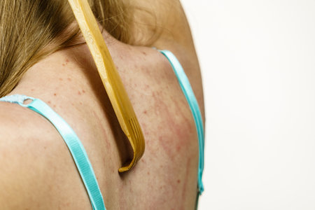 Itchy skin, dermatitis, food allergies. Woman using scratching wood stick to scratch her back side. Female having itching, allergy rash.の写真素材