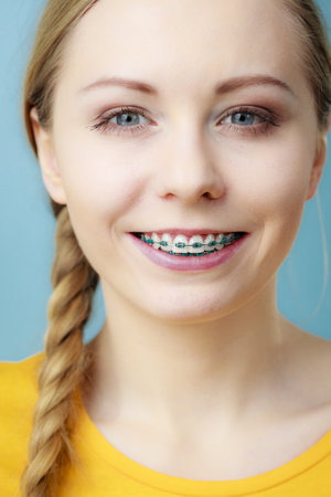 Dentist and orthodontist concept. Young woman teen girl smiling showing teeth with braces, on blueの写真素材