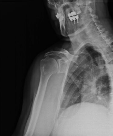 Xrayの写真素材