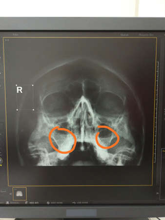 CT scans of the head on the screenの写真素材