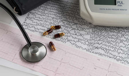 modern electric tonometer and a stethoscope on a cardiogram chart. household blood pressure monitor