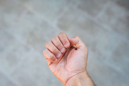 A man's hand with bitten and ugly fingernails. Bad care of handsの写真素材