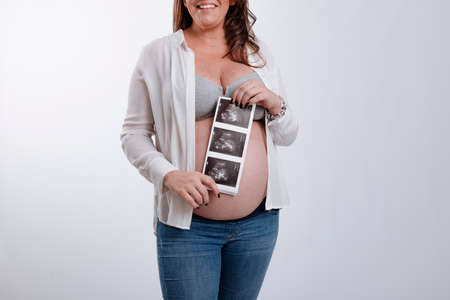 Unrecognizable pregnant woman holding ultrasound images of her unborn baby over the belly on white backgroundの写真素材