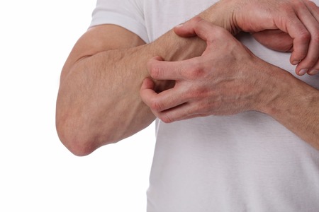 Man Scratching an itch on white background . Sensitive Skin, Allergic Reaction, Irritationの写真素材