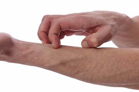 Man Scratching an itch on white background . Sensitive Skin, Allergic Reaction, Irritation