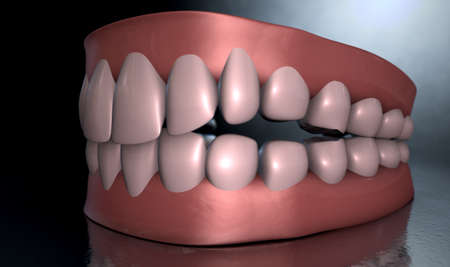 A sinister dramatic depiction of seperated upper and lower sets of human teeth set in gums on a dark...
