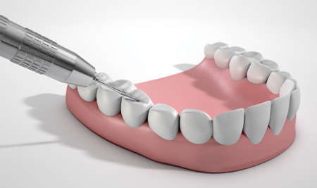 A closeup of a steel dentists drill performing an examination on a set of false teeth on an isolated...