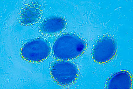 Lillium Anther under Optical Microscope