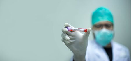 Coronavirus Covid-19 Blood Sample - Corona virus outbreaking. Epidemic virus Respiratory Syndrome