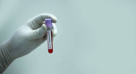 Coronavirus Covid-19 Blood Sample - Corona virus outbreaking. Epidemic virus Respiratory Syndromeの写真素材