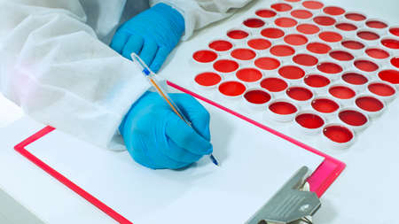Close up to doctor with blue gloves writing on a white sheet of paper sitting next to a group of...