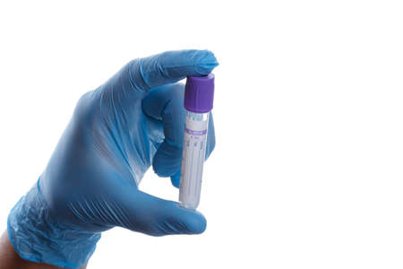 Hand with a test tube on a white backgroundの写真素材