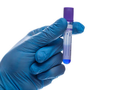 Hand with a test tube on a white background