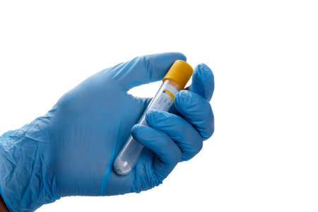 Hand with a test tube on a white backgroundの写真素材