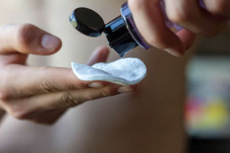 Skin care.A young man holds a cotton pad and a lotion to cleanse the skin of blackheadsの写真素材