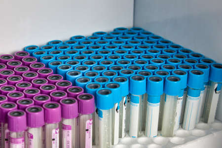 Set of empty vacuum tubes for taking venous blood in a clinical laboratory. Close-up of vacutainers...