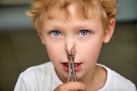 Close-up of a cute blue-eyed boy looks into the camera holding his nose with medical forceps. Curly child breathes with his mouth holding his nose with a medical instrumentの写真素材