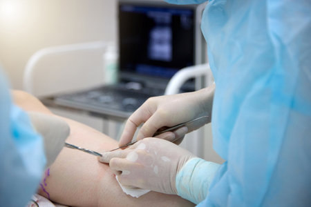 Close-up of an experienced surgeon gently punctures the patients vein to install a catheter in the treatment of varicose veins. Surgical treatment of varicose veinsの写真素材