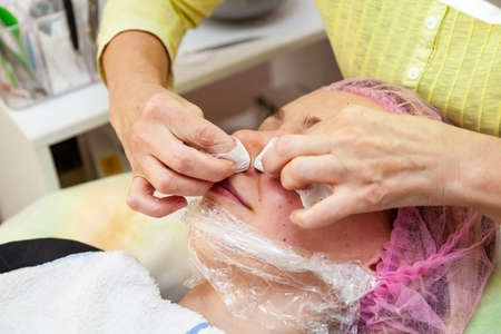 A young girl is lying on a couch during cosmetic procedures with a mask on the face above which beautician woman squeezes body fat and pimples with wipes on nose. Cleansing and make up.の写真素材