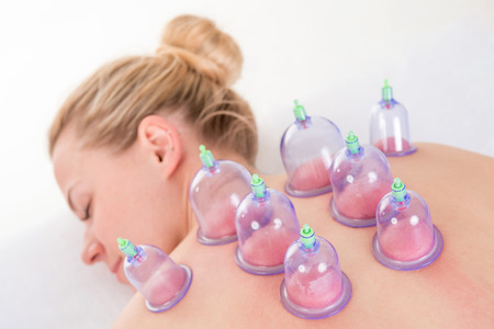 young woman having Vacuum Massage (vacuum therapy, cupping-glass massage) in professional Physiotherapy clinicの写真素材