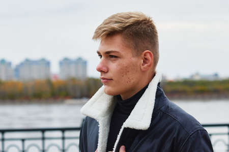 Portrait of a young man in profile outdoors. Acne skin. In a blur in the background, the river, forest and buildings.の写真素材