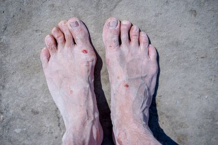 Bare feet of men in the pink salt lake. Salt Deposit. Treatment of wounds with salt. Healing...