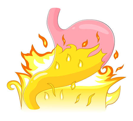 Stomach heartburnのイラスト素材