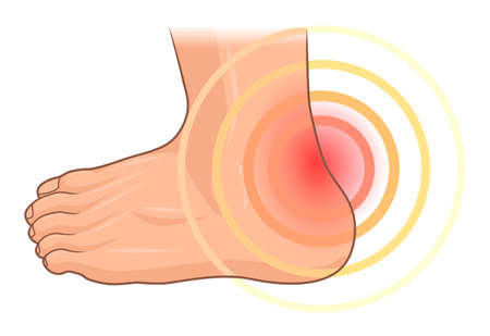 Heel painのイラスト素材