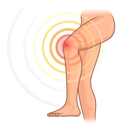 Knee painのイラスト素材