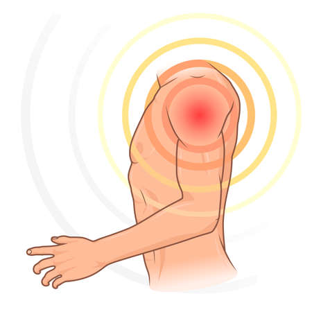 Shoulder painのイラスト素材
