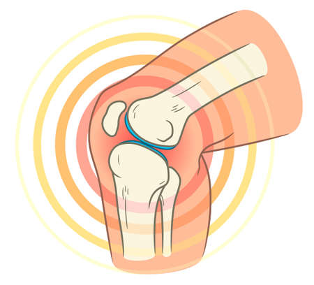 Knee joint pain illustration isolated on white backgroundのイラスト素材