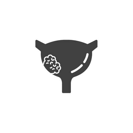 Bladder cancer vector icon. filled flat sign for mobile concept and web design. Bladder with cancer tumor glyph icon. Symbol, logo illustration. Vector graphicsのイラスト素材