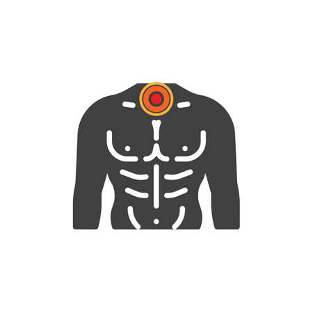 Sore throat pain vector icon. filled flat sign for mobile concept and web design. Sore throat ache glyph icon. Symbol, logo illustration. Vector graphicsのイラスト素材
