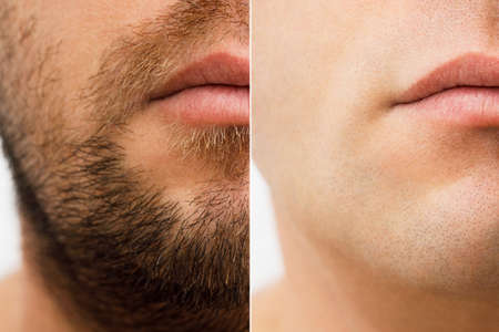 Close up photo of a mans face before and after shaving. a young man with a beard. Comparison of a mans face with a beard and without a beard. use of aftershave cream.の写真素材