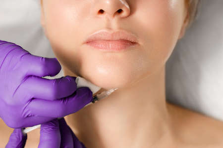 A cosmetologist performs a procedure for correcting the shape of a womans chin. Injections into the...