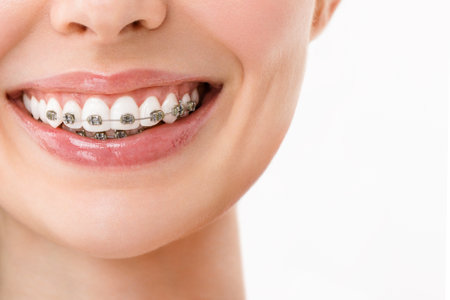A smiling woman with metal braces. Close-upの写真素材
