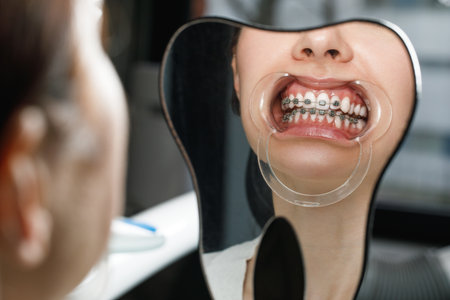 Closeup young woman checking her braces, smiling.の写真素材