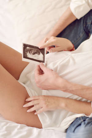 man embracing a pregnant woman and holding ultrasound photoの写真素材