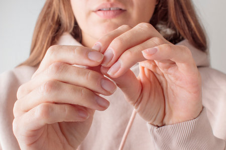 Onychophagy. A nervous young woman is biting her nail due to stress and anxiety. Concept of anxiety, stress, bad habits, mental healthの写真素材