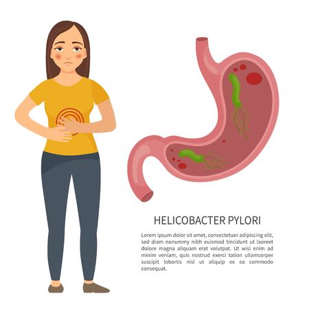 Helicobacter pylori. Diseases of the stomach. Flat illustration. A cartoon character.のイラスト素材