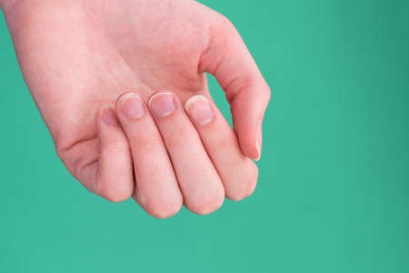 Close-up of brittle nails, Caucasian female hand on a green background, close-up, copy space....
